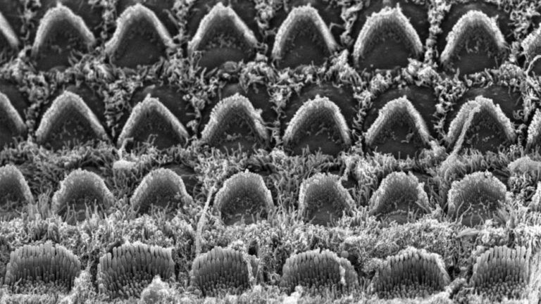 Organ of Corti hair cells - the sensory cells of the inner ear In mammals, three rows of outer hair cells and one row of inner hair cells secure our sense of hearing. Learn more about PKHD1L1