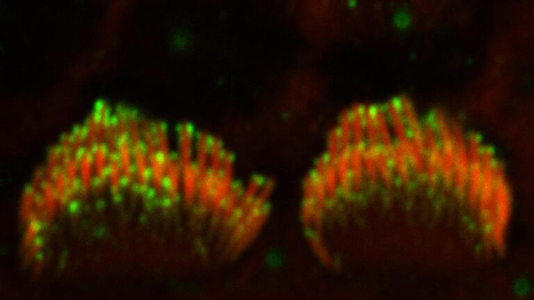 Inner hair cell stereocilia bundles labeled with anti-Cdh23 antibodies Learn more about the proteins that form the hair cell tip link